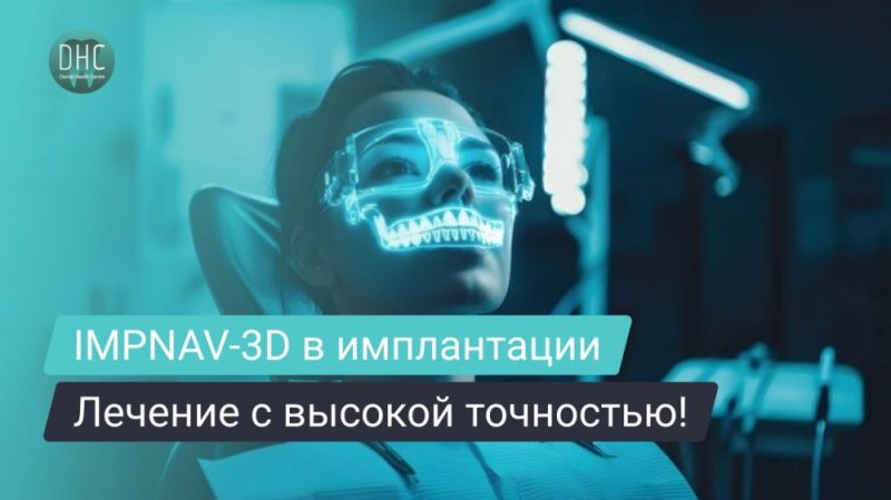 Динамическая навигация в стоматологии: преимущества системы IMPNAV-3D