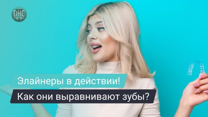 Как элайнеры помогают выровнять зубы и улучшить прикус?