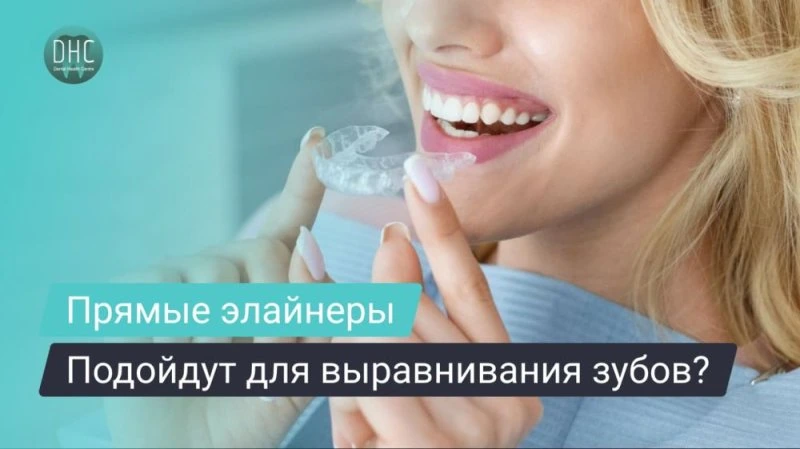 Как понять, подойдут ли мне прямые элайнеры?