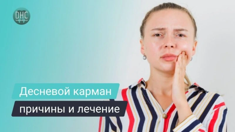 Десневой карман - причины, симптомы, лечение