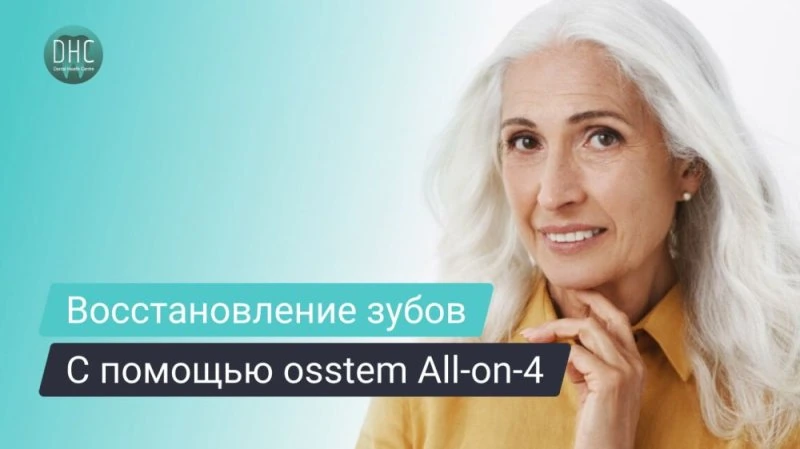 Имплантация зубов на 4-х имплантатах Osstem