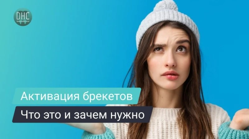 Что такое активация брекетов и зачем она нужна при исправлении прикуса