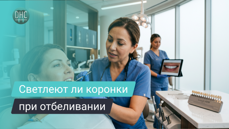 Отбеливание зубов с коронками: можно ли и что важно учитывать