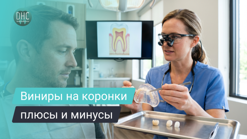 Виниры на зубы: когда можно ставить и как они сочетаются с коронками и пломбами.