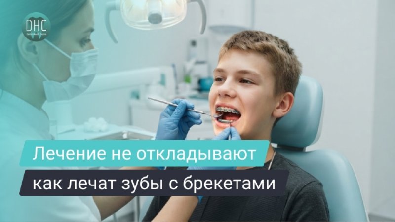 Можно ли лечить зубы с брекетами: что важно знать и как проходит лечение