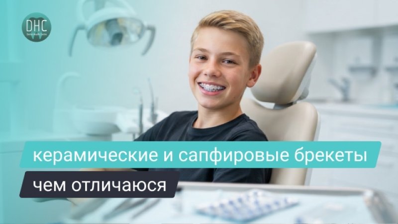 Керамические или сапфировые брекеты: как выбрать и чем они отличаются