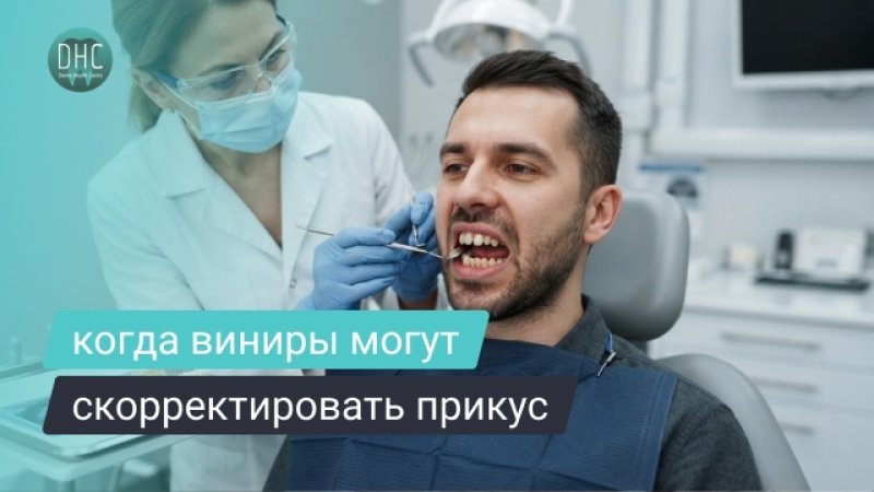 Можно ли исправить прикус винирами: когда это реально, а когда нет