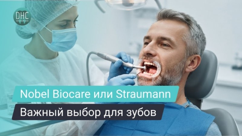 Импланты Nobel Biocare или Straumann: что лучше выбрать в вашем случае?